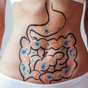 Why Choose Functional Medicine?